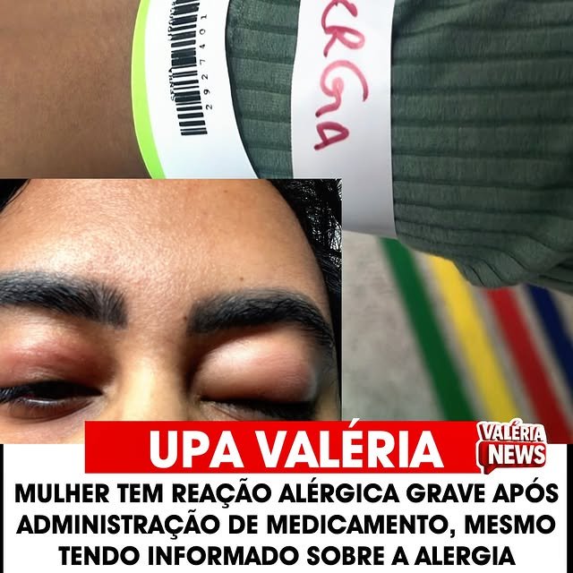 Na manhã desta quarta-feira (12/11), uma mulher teve reação alérgica grave após ser administrado …